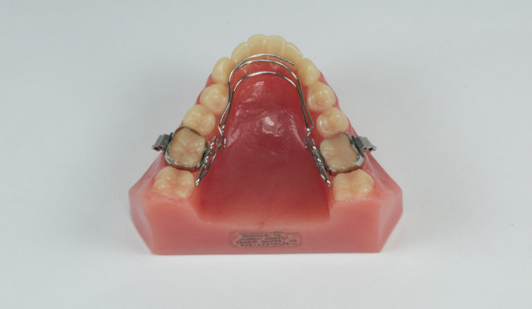 Wilson Mandibular Quad Action - Johns Dental Lab