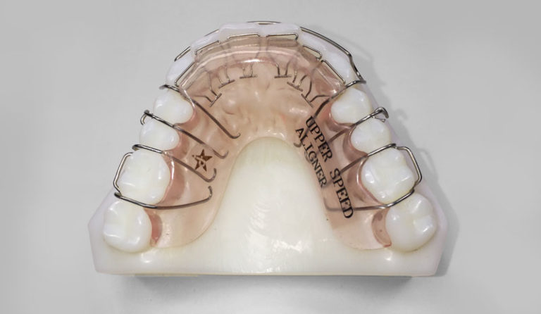 Speedaligner™ - Johns Dental Lab